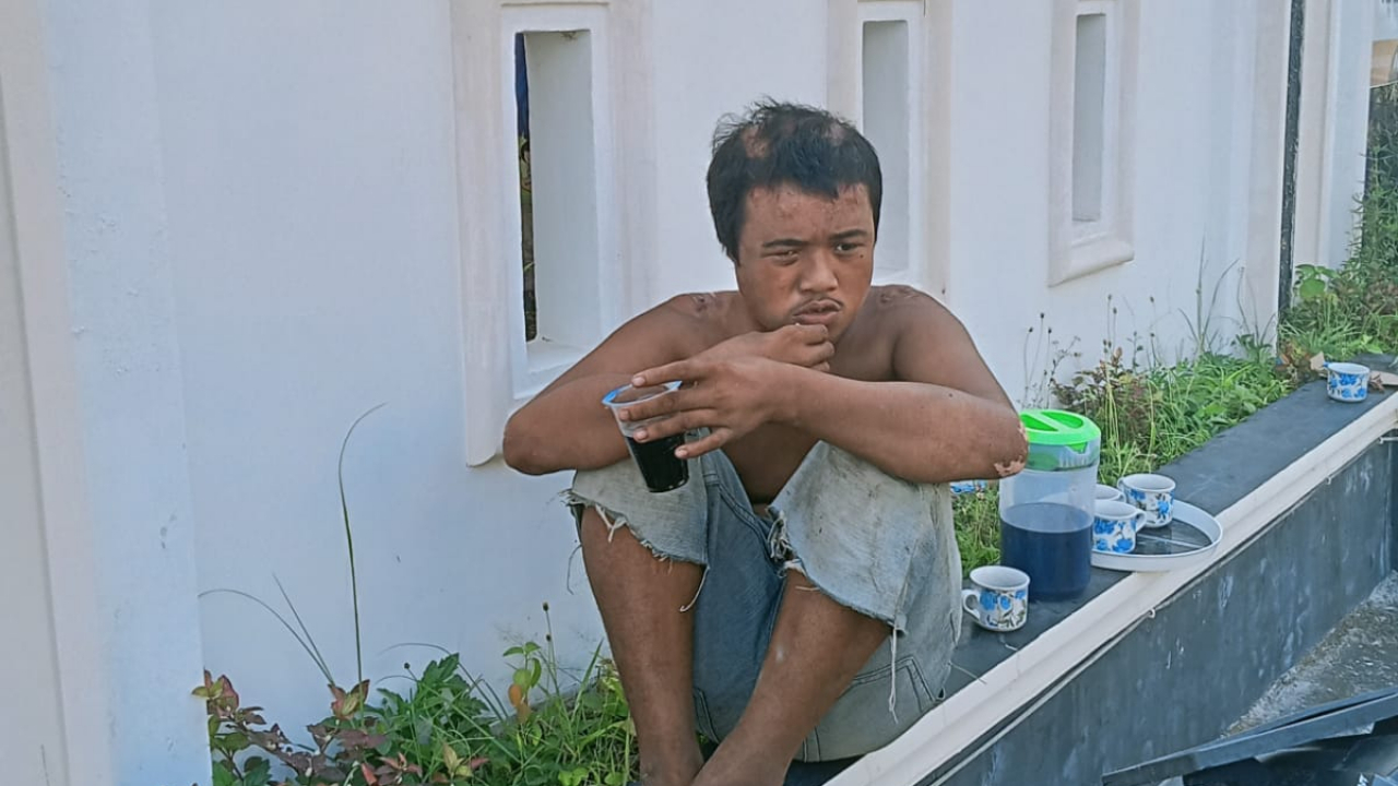 Ikhtiar, Doa, dan Harapan: Perkembangan Kesembuhan Adik Rudi, Warga Kelurahan Lembang yang Mengalami Musibah Kebakaran